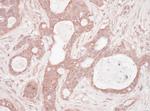 Sequestosome-1 Antibody in Immunohistochemistry (Paraffin) (IHC (P))