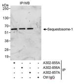 Sequestosome-1 Antibody in Immunoprecipitation (IP)