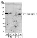 Sequestosome-1 Antibody in Western Blot (WB)