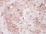 Sequestosome-1 Antibody in Immunohistochemistry (Paraffin) (IHC (P))