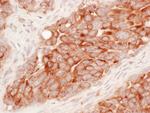 Reticulon-3 Antibody in Immunohistochemistry (Paraffin) (IHC (P))