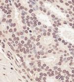 RNF2 Antibody in Immunohistochemistry (Paraffin) (IHC (P))