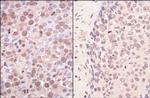 SmcHD1 Antibody in Immunohistochemistry (Paraffin) (IHC (P))