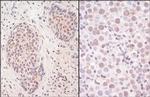 SmcHD1 Antibody in Immunohistochemistry (Paraffin) (IHC (P))