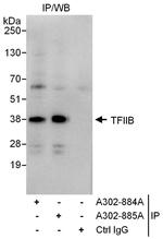 GTF2B/TFIIB Antibody in Immunoprecipitation (IP)