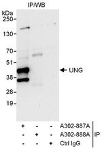 UNG Antibody in Immunoprecipitation (IP)