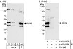 UNG Antibody in Western Blot (WB)