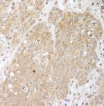 Cbl-b Antibody in Immunohistochemistry (Paraffin) (IHC (P))