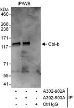 Cbl-b Antibody in Immunoprecipitation (IP)