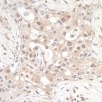 RABGEF1 Antibody in Immunohistochemistry (Paraffin) (IHC (P))