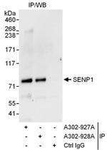 SENP1 Antibody in Immunoprecipitation (IP)