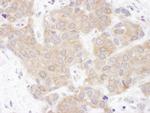 VCIP135 Antibody in Immunohistochemistry (Paraffin) (IHC (P))