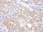 VCIP135 Antibody in Immunohistochemistry (Paraffin) (IHC (P))