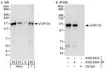 VCIP135 Antibody in Western Blot (WB)