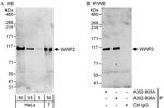 WWP2 Antibody in Western Blot (WB)