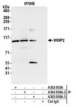 WWP2 Antibody in Immunoprecipitation (IP)