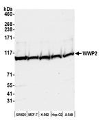 WWP2 Antibody in Western Blot (WB)