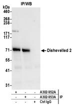 Dishevelled 2 Antibody in Immunoprecipitation (IP)