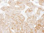 NHERF1 Antibody in Immunohistochemistry (Paraffin) (IHC (P))