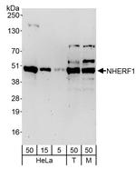 NHERF1 Antibody in Western Blot (WB)