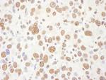 eIF4AIII/EIF4A3 Antibody in Immunohistochemistry (Paraffin) (IHC (P))