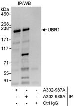 UBR1 Antibody in Immunoprecipitation (IP)