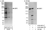 UBR1 Antibody in Western Blot (WB)