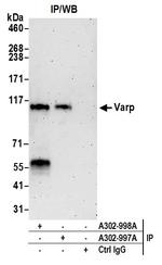 Varp Antibody in Immunoprecipitation (IP)