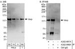 Varp Antibody in Western Blot (WB)