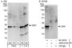 DRP Antibody in Western Blot (WB)