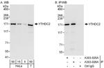 YTHDC2 Antibody in Western Blot (WB)