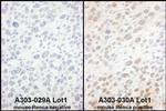 eIF6 Antibody in Immunohistochemistry (Paraffin) (IHC (P))