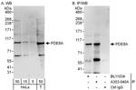 PDE8A Antibody in Western Blot (WB)