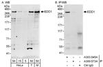 EDD1 Antibody in Western Blot (WB)