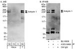 Ankyrin 1 Antibody in Western Blot (WB)