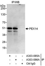 PEX14 Antibody in Immunoprecipitation (IP)