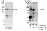 NSD2 Antibody in Western Blot (WB)