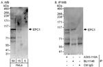 EPC1 Antibody in Western Blot (WB)