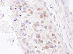 NF90/NF110 Antibody in Immunohistochemistry (Paraffin) (IHC (P))