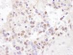 NF90/NF110 Antibody in Immunohistochemistry (Paraffin) (IHC (P))