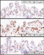 NF90/NF110 Antibody in Immunohistochemistry (Paraffin) (IHC (P))