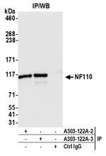 NF110 Antibody in Immunoprecipitation (IP)