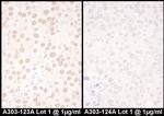 NFIC Antibody in Immunohistochemistry (Paraffin) (IHC (P))