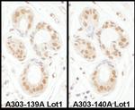 SENP3 Antibody in Immunohistochemistry (Paraffin) (IHC (P))