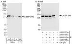 C/EBP zeta Antibody in Western Blot (WB)