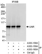 UNR Antibody in Immunoprecipitation (IP)