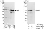 SRF Antibody in Western Blot (WB)