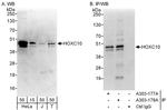 HOXC10 Antibody in Western Blot (WB)