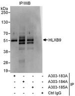 HLXB9 Antibody in Immunoprecipitation (IP)