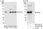 TDP43 Antibody in Western Blot (WB)